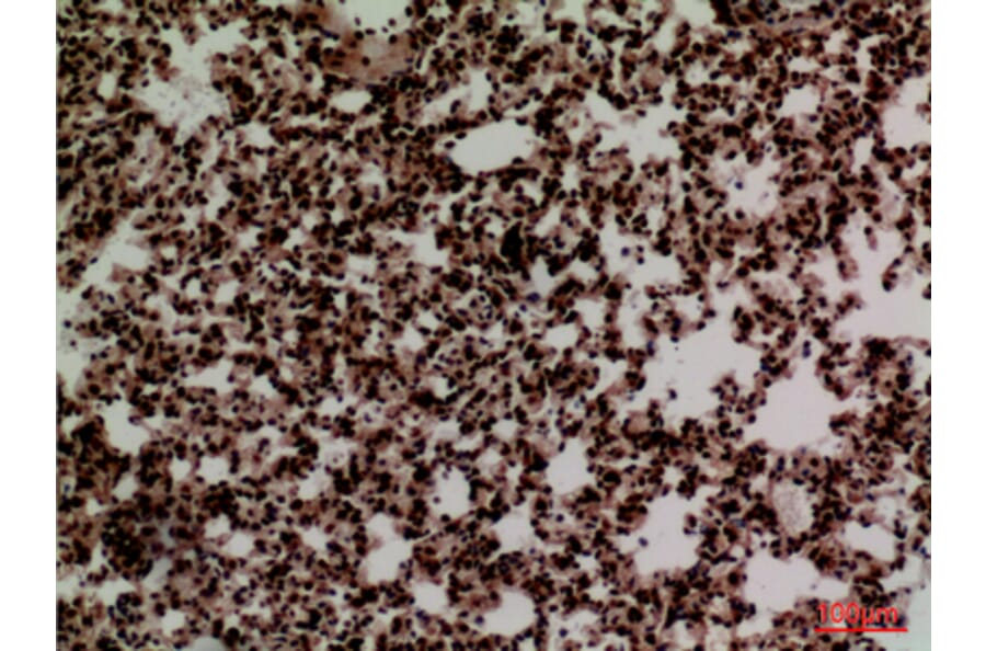 Immunohistochemistry - Anti-FOXP1 Antibody (C30231) - Antibodies.com
