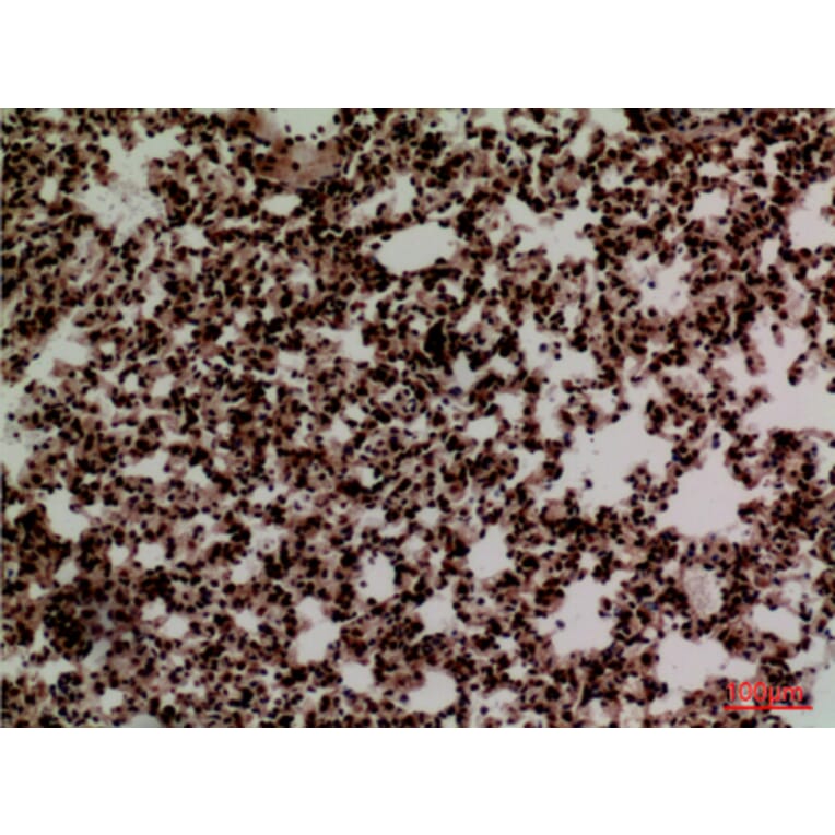 Immunohistochemistry - Anti-FOXP1 Antibody (C30231) - Antibodies.com