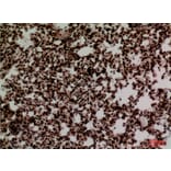 Immunohistochemistry - Anti-FOXP1 Antibody (C30231) - Antibodies.com