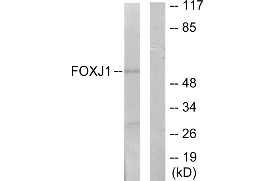 Western Blot - Anti-FOXJ1 Antibody (C11446) - Antibodies.com