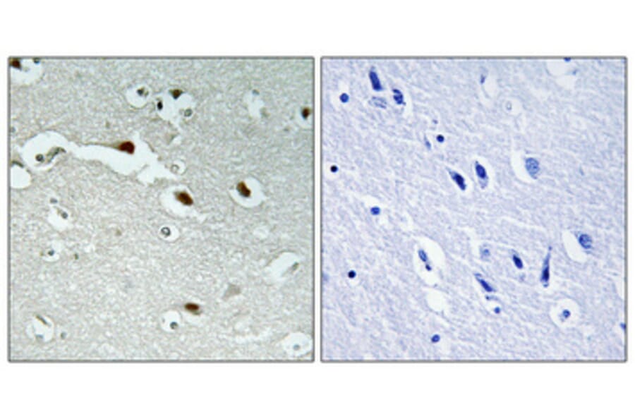 Immunohistochemistry - Anti-FOXJ1 Antibody (C11446) - Antibodies.com