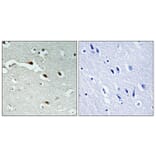 Immunohistochemistry - Anti-FOXJ1 Antibody (C11446) - Antibodies.com