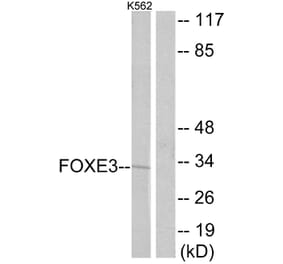 Western Blot - Anti-FOXE3 Antibody (C10979) - Antibodies.com
