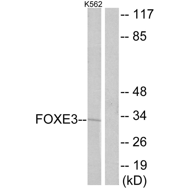 Western Blot - Anti-FOXE3 Antibody (C10979) - Antibodies.com