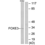 Western Blot - Anti-FOXE3 Antibody (C10979) - Antibodies.com