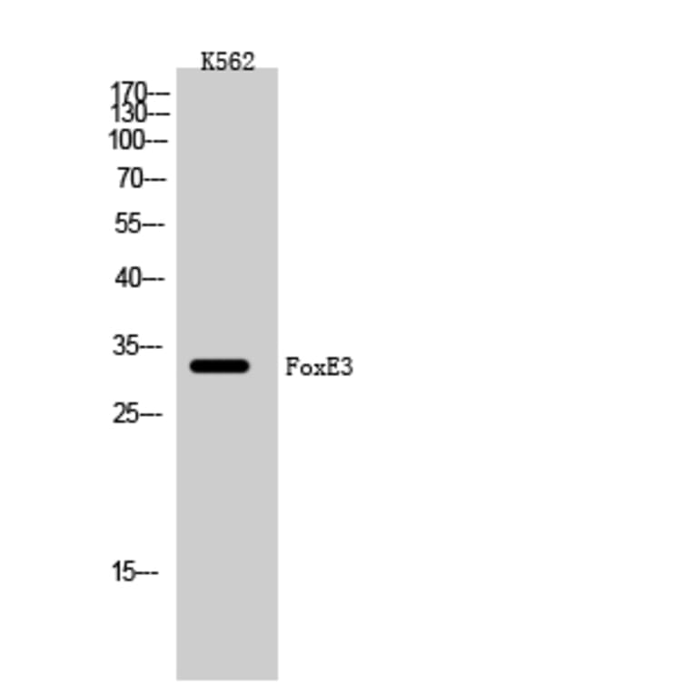 Western Blot - Anti-FOXE3 Antibody (C10979) - Antibodies.com