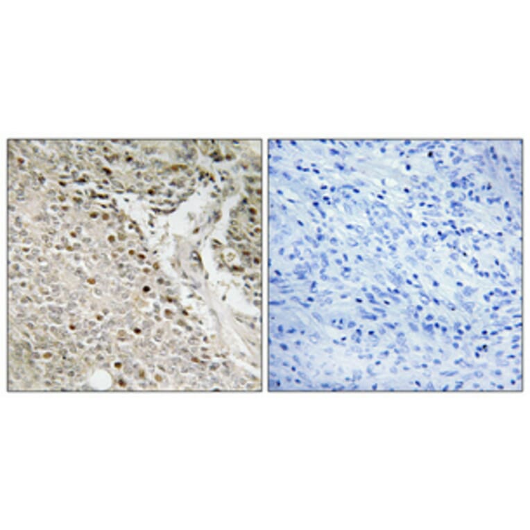 Immunohistochemistry - Anti-FOXE3 Antibody (C10979) - Antibodies.com