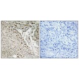Immunohistochemistry - Anti-FOXE3 Antibody (C10979) - Antibodies.com