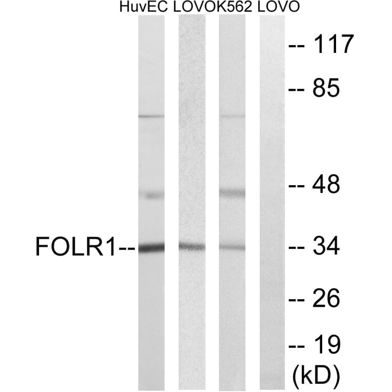 Western Blot - Anti-FOLR1 Antibody (C15761) - Antibodies.com