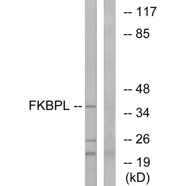 Western Blot - Anti-FKBPL Antibody (C15758) - Antibodies.com