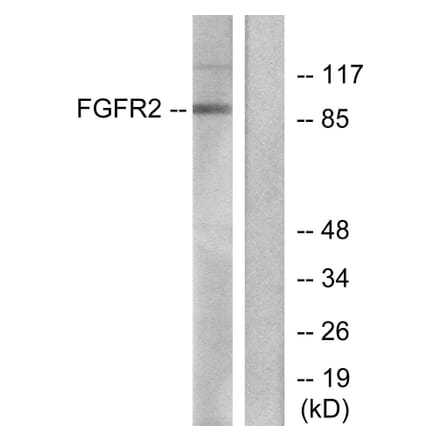 Western Blot - Anti-FGFR2 Antibody (C0191) - Antibodies.com