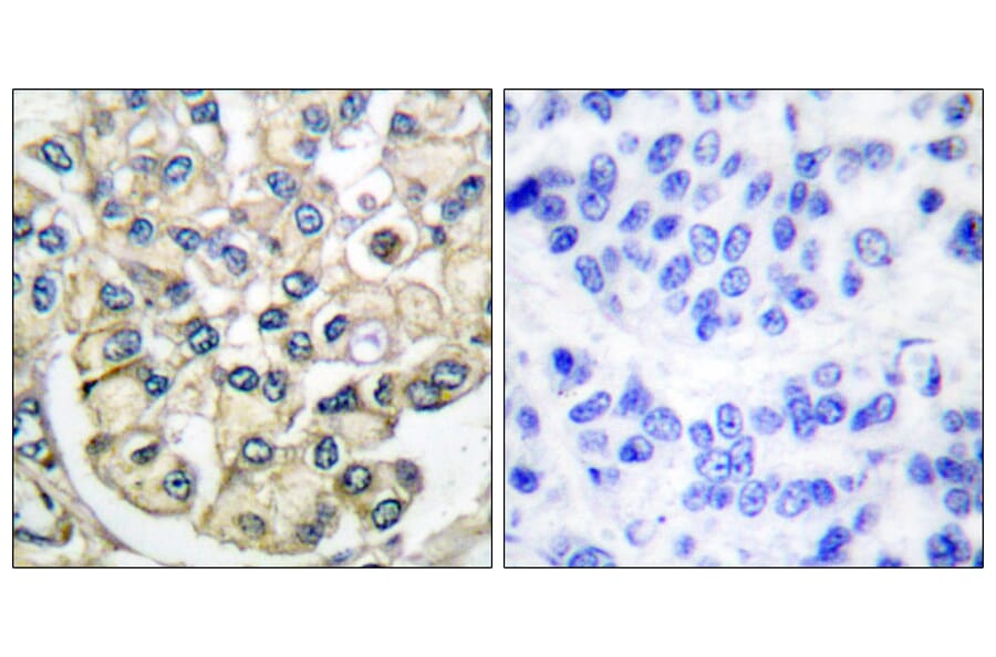 Immunohistochemistry - Anti-FGFR2 Antibody (C0191) - Antibodies.com