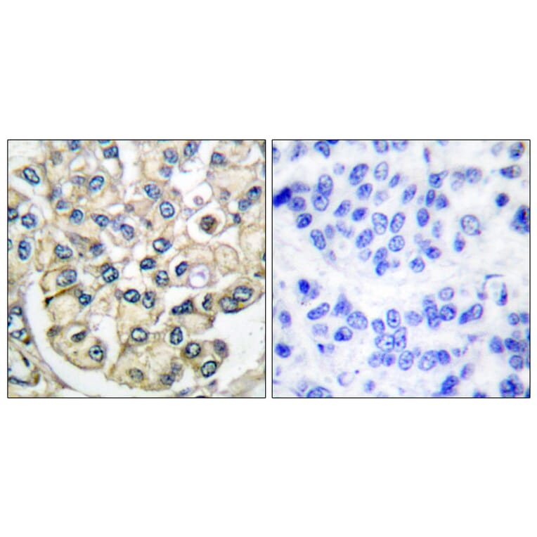 Immunohistochemistry - Anti-FGFR2 Antibody (C0191) - Antibodies.com