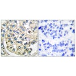 Immunohistochemistry - Anti-FGFR2 Antibody (C0191) - Antibodies.com