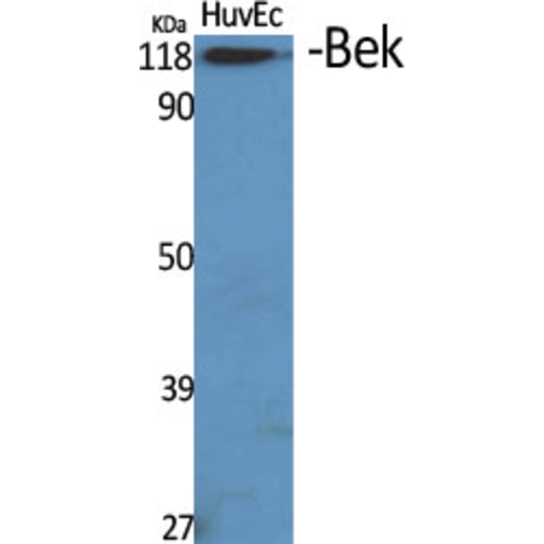 Western Blot - Anti-FGFR2 Antibody (C0191) - Antibodies.com