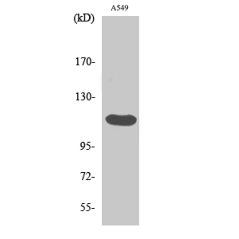Western Blot - Anti-FGFR2 Antibody (C0191) - Antibodies.com