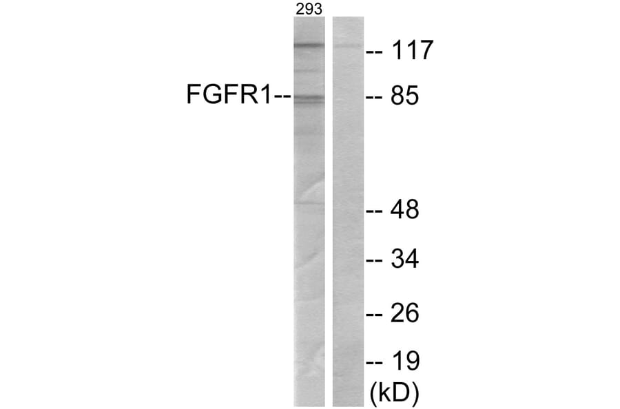 Western Blot - Anti-FGFR1 Antibody (B7084) - Antibodies.com