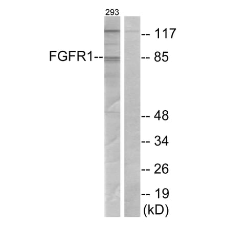Western Blot - Anti-FGFR1 Antibody (B7084) - Antibodies.com