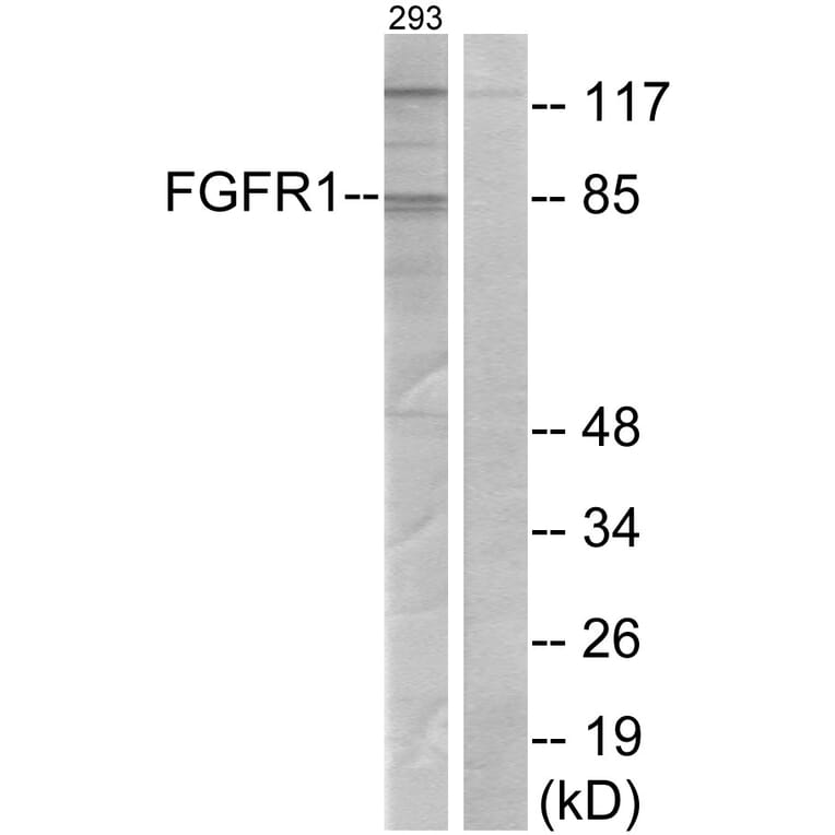 Western Blot - Anti-FGFR1 Antibody (B7084) - Antibodies.com