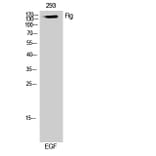 Western Blot - Anti-FGFR1 Antibody (B7084) - Antibodies.com