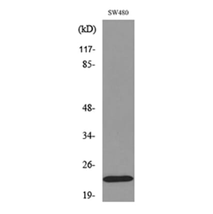 Western Blot - Anti-FGF20 Antibody (C30099) - Antibodies.com