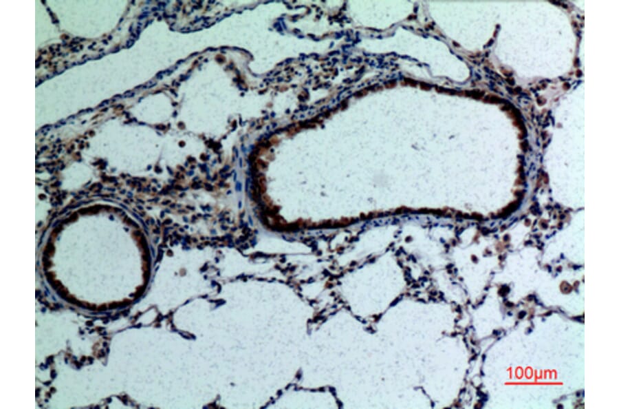 Immunohistochemistry - Anti-FGF18 Antibody (C30104) - Antibodies.com