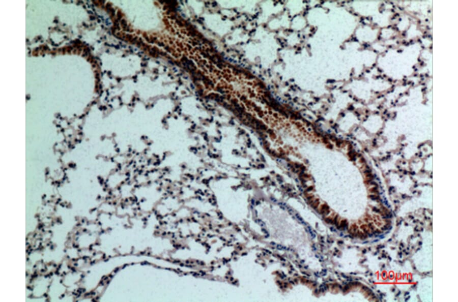 Immunohistochemistry - Anti-FGF18 Antibody (C30104) - Antibodies.com
