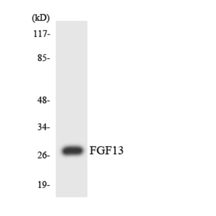 Western Blot - Anti-FGF13 Antibody (R12-2769) - Antibodies.com