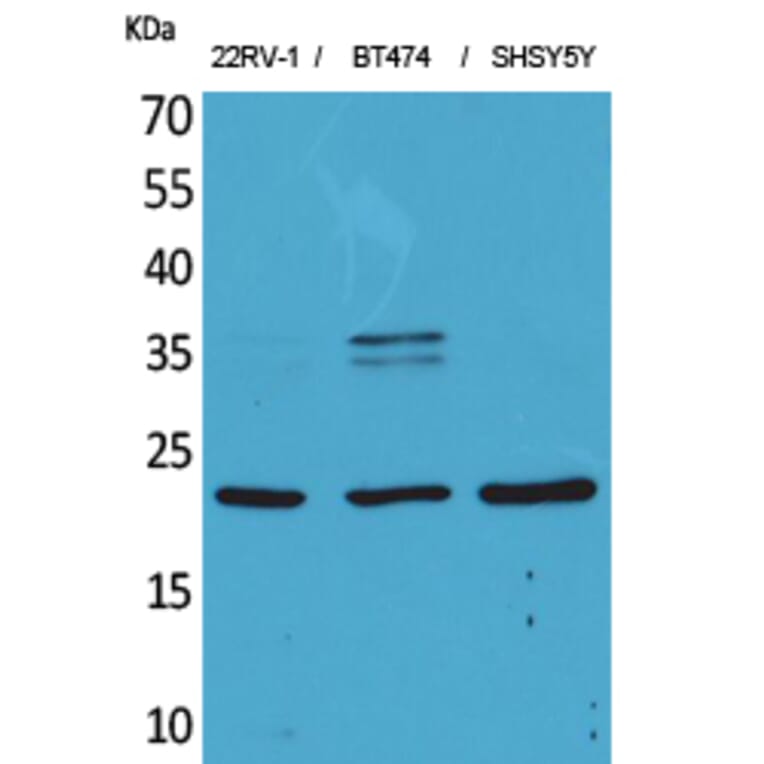 Western Blot - Anti-FGF12 Antibody (C30048) - Antibodies.com