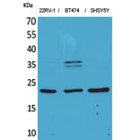 Western Blot - Anti-FGF12 Antibody (C30048) - Antibodies.com
