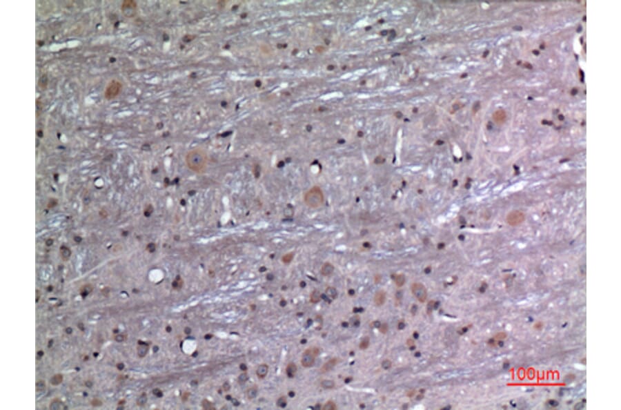 Immunohistochemistry - Anti-FGF12 Antibody (C30048) - Antibodies.com
