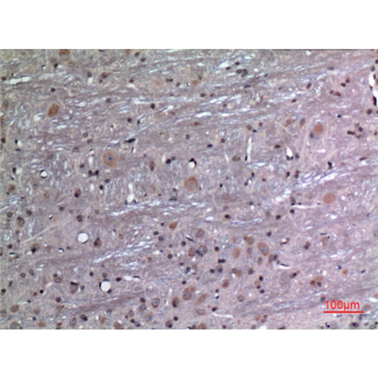 Immunohistochemistry - Anti-FGF12 Antibody (C30048) - Antibodies.com