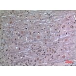 Immunohistochemistry - Anti-FGF12 Antibody (C30048) - Antibodies.com