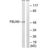 Western Blot - Anti-FBLN5 Antibody (C15754) - Antibodies.com