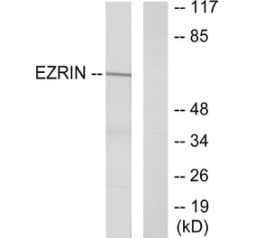 Western Blot - Anti-Ezrin Antibody (B7080) - Antibodies.com