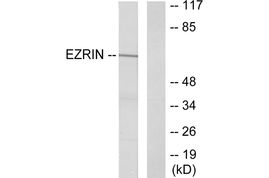 Western Blot - Anti-Ezrin Antibody (B7080) - Antibodies.com
