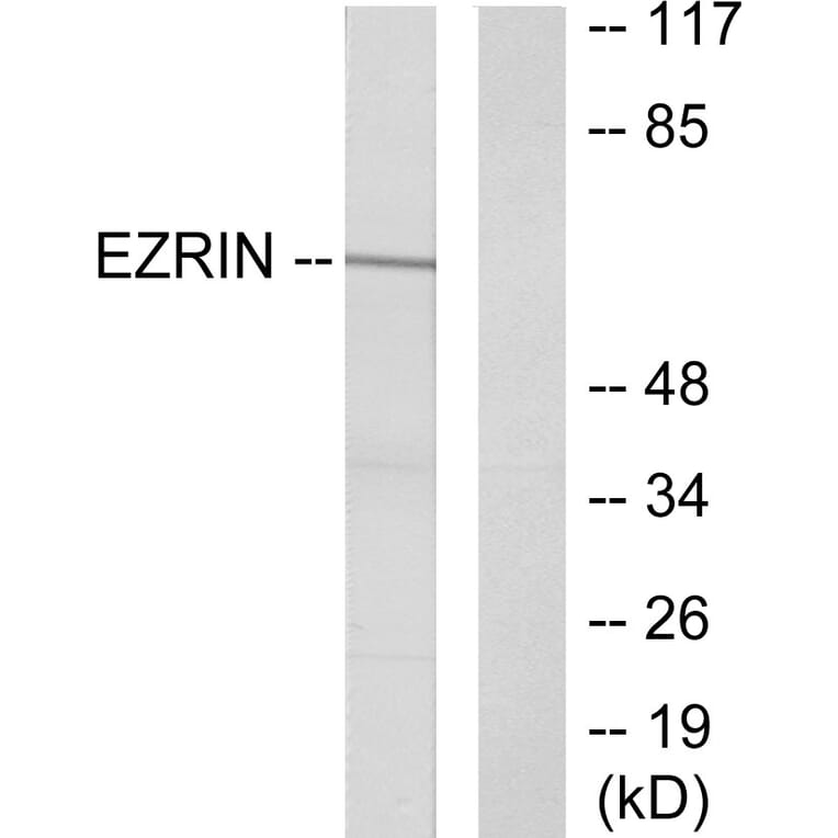 Western Blot - Anti-Ezrin Antibody (B7080) - Antibodies.com