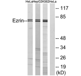 Western Blot - Anti-Ezrin Antibody (B7079) - Antibodies.com