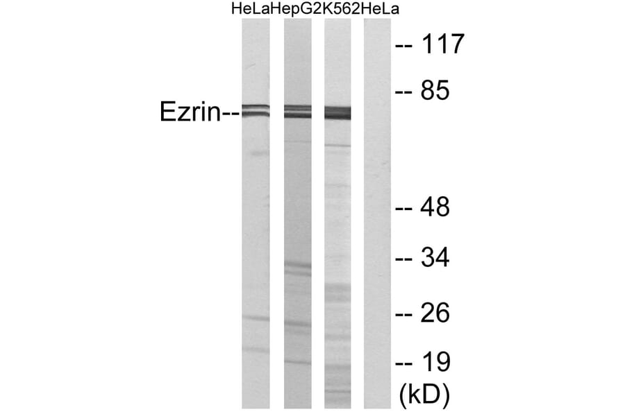 Western Blot - Anti-Ezrin Antibody (B7079) - Antibodies.com