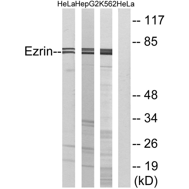 Western Blot - Anti-Ezrin Antibody (B7079) - Antibodies.com