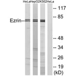 Western Blot - Anti-Ezrin Antibody (B7079) - Antibodies.com