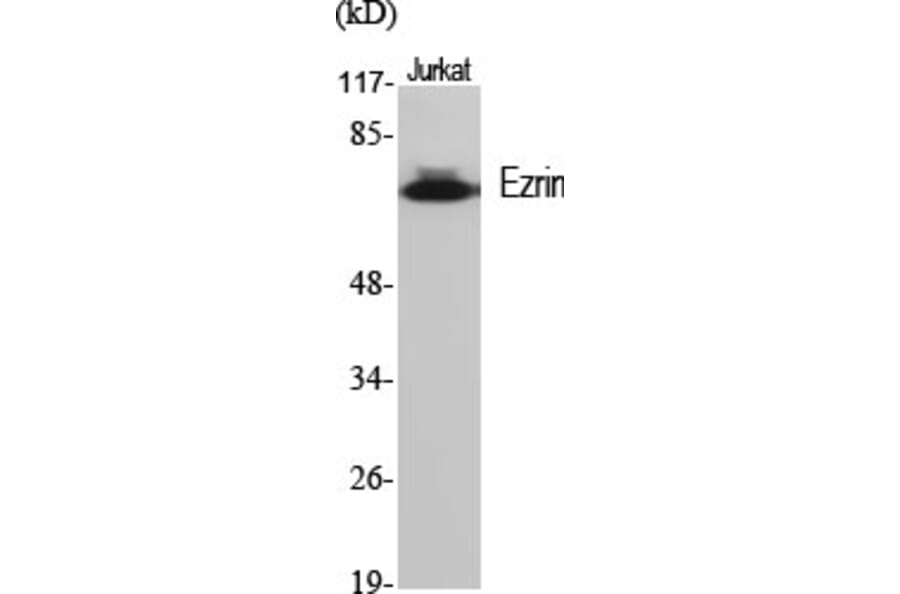 Western Blot - Anti-Ezrin Antibody (B7079) - Antibodies.com