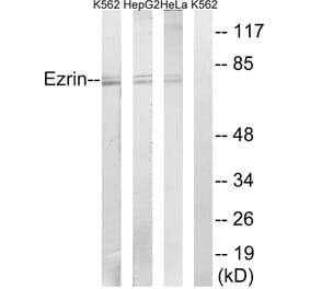 Western Blot - Anti-Ezrin Antibody (B8030) - Antibodies.com