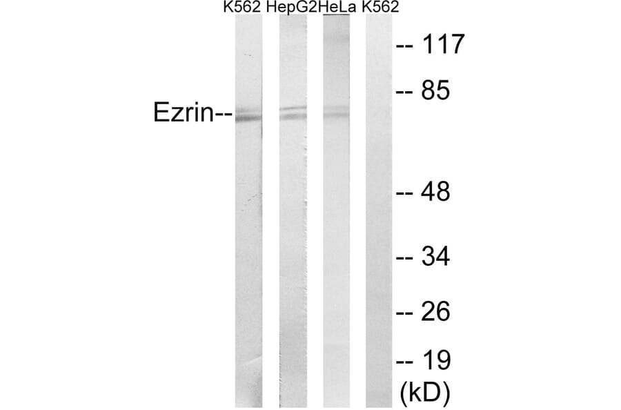 Western Blot - Anti-Ezrin Antibody (B8030) - Antibodies.com