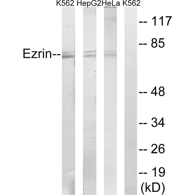 Western Blot - Anti-Ezrin Antibody (B8030) - Antibodies.com