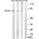 Western Blot - Anti-Ezrin Antibody (B8030) - Antibodies.com