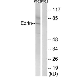 Western Blot - Anti-Ezrin Antibody (B8031) - Antibodies.com