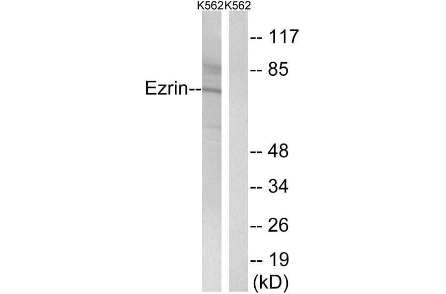 Western Blot - Anti-Ezrin Antibody (B8031) - Antibodies.com