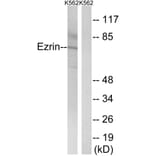 Western Blot - Anti-Ezrin Antibody (B8031) - Antibodies.com