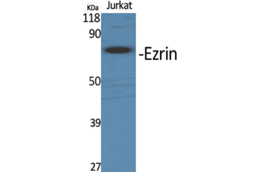 Western Blot - Anti-Ezrin Antibody (B8031) - Antibodies.com